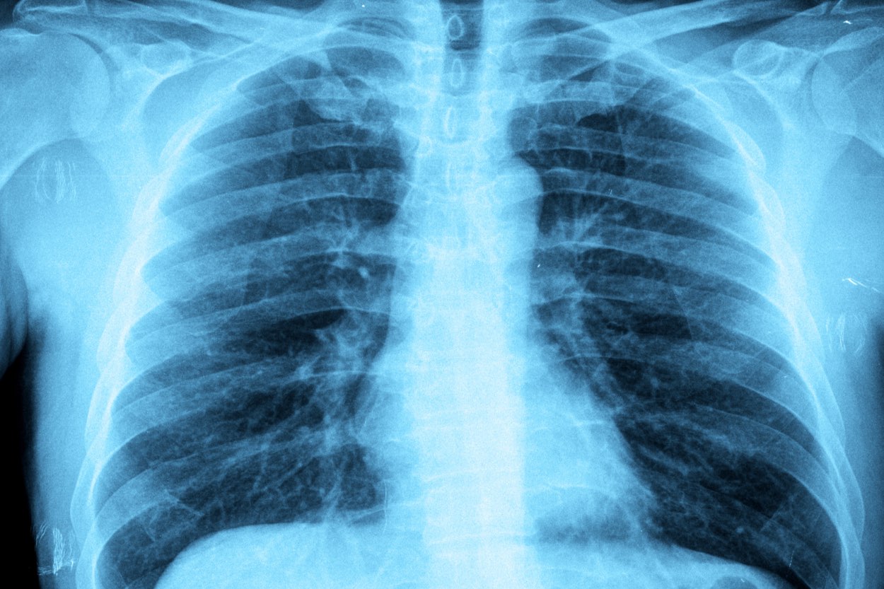 Doctor Viewing An X-Ray